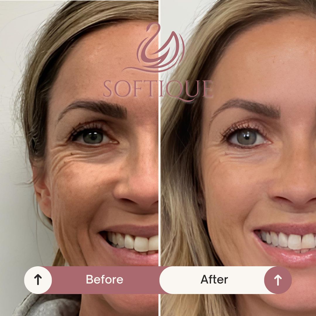 Natural Retinol